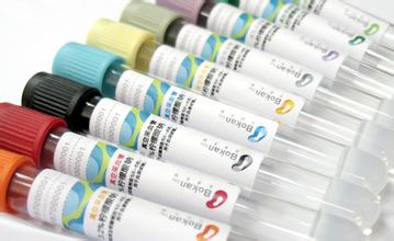 12月8号，，，，，新宝GG被评为2011年度上海市优异手艺带动人