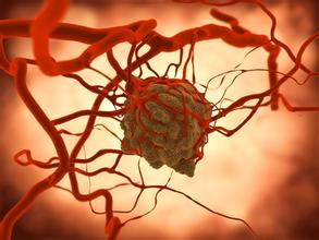 复旦大学CellResearch展现新型癌症标记物