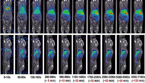 新宝GGPET/CT分子影像手艺平台