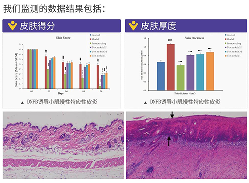 新宝GG建设的特应性皮炎及湿疹模子监测数据效果