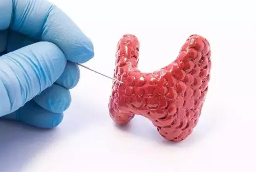 甲状腺疾病，，，，，，包括甲状腺功效减退和甲状腺功效亢进，，，，，，自古以来就是重复被医学研究职员研究的疾病