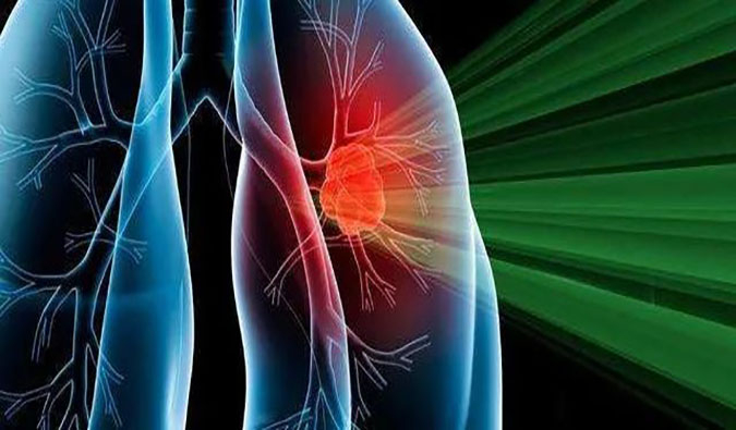 盛世泰科1类立异药物CGT-9475实现中美双报双批 | 新宝GG一站式临床宿世物医药研发服务平台助力