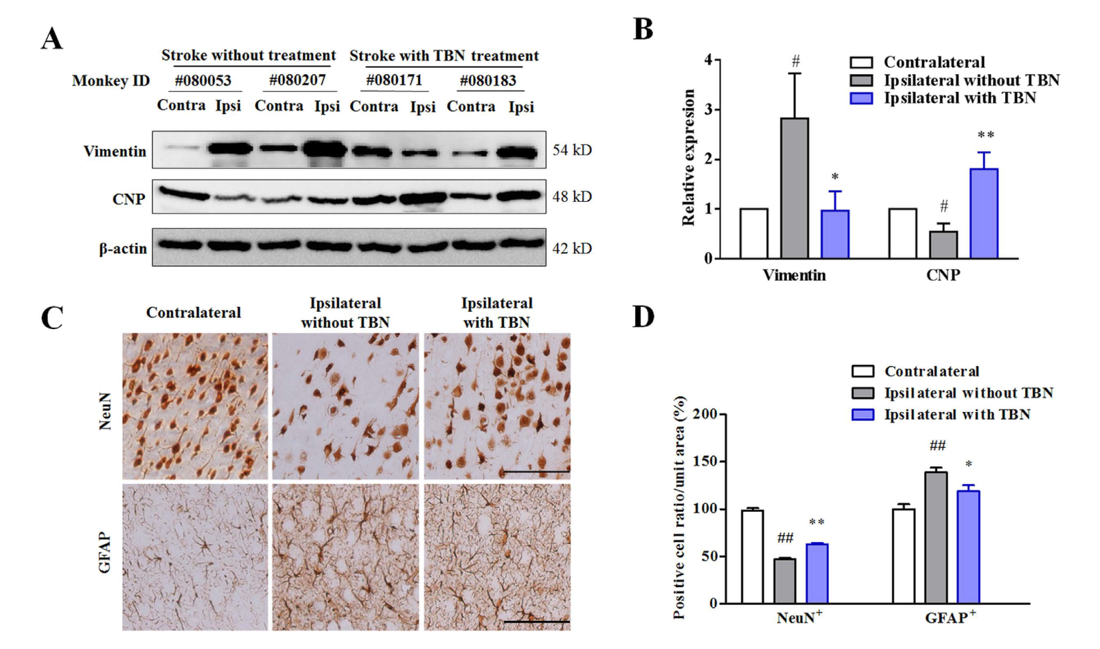 TBN是一种治疗缺血性卒中的新型临床候选药物，，本研究中TBN通过新宝GG合成